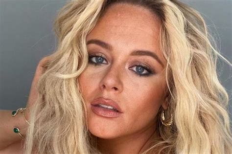 emily atack hot|Emily Atack flaunts jaw